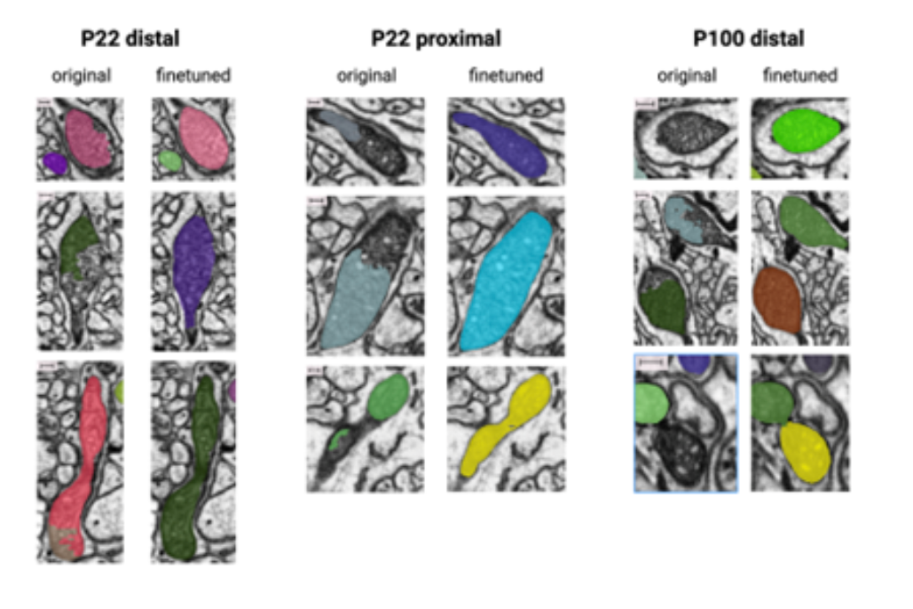image showing original and finetuned segmentations in proximal and distal neurons
